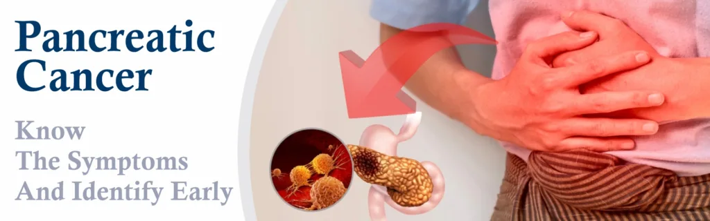 Pancreatic Cancer – Know the Symptoms and Identify Early