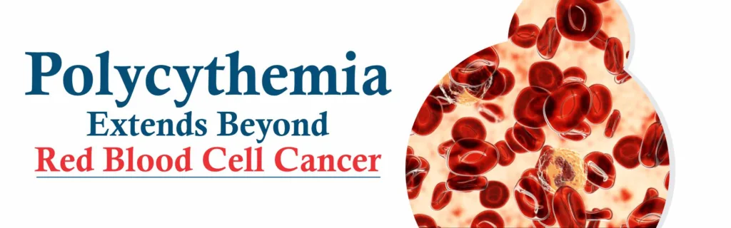 Polycythemia Extends Beyond Red Blood Cell Cancer