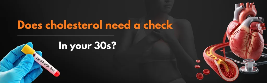 Does cholesterol need a check in your 30s?