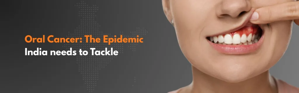Oral Cancer: The Epidemic India needs to Tackle
