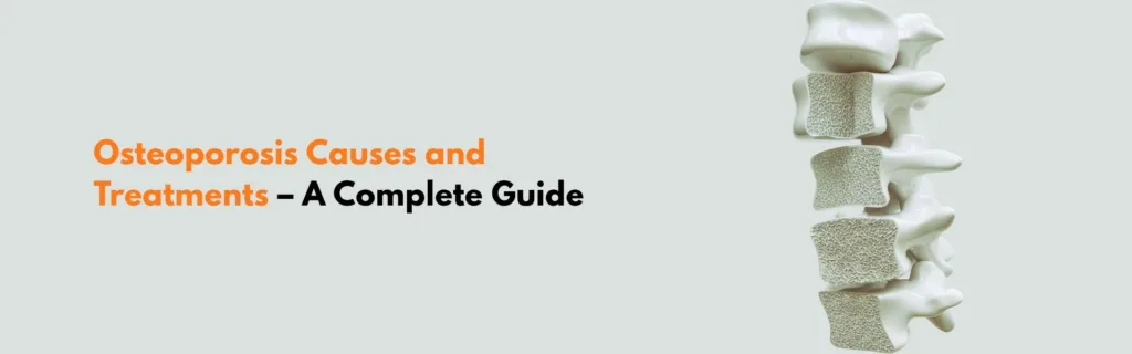 Osteoporosis Causes and Treatments – A Complete Guide