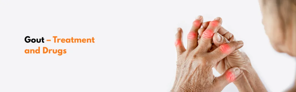 Gout – Treatment and Drugs